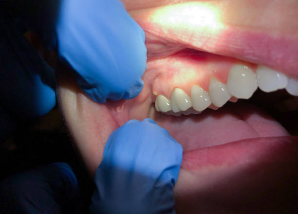 Best Dentist Open Late Near Me  in Sugarland Run, VA